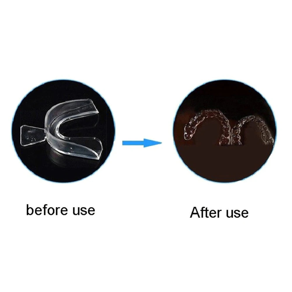 NoGrind Teeth Guard