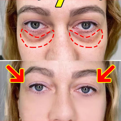 Puffy Peepers Fix