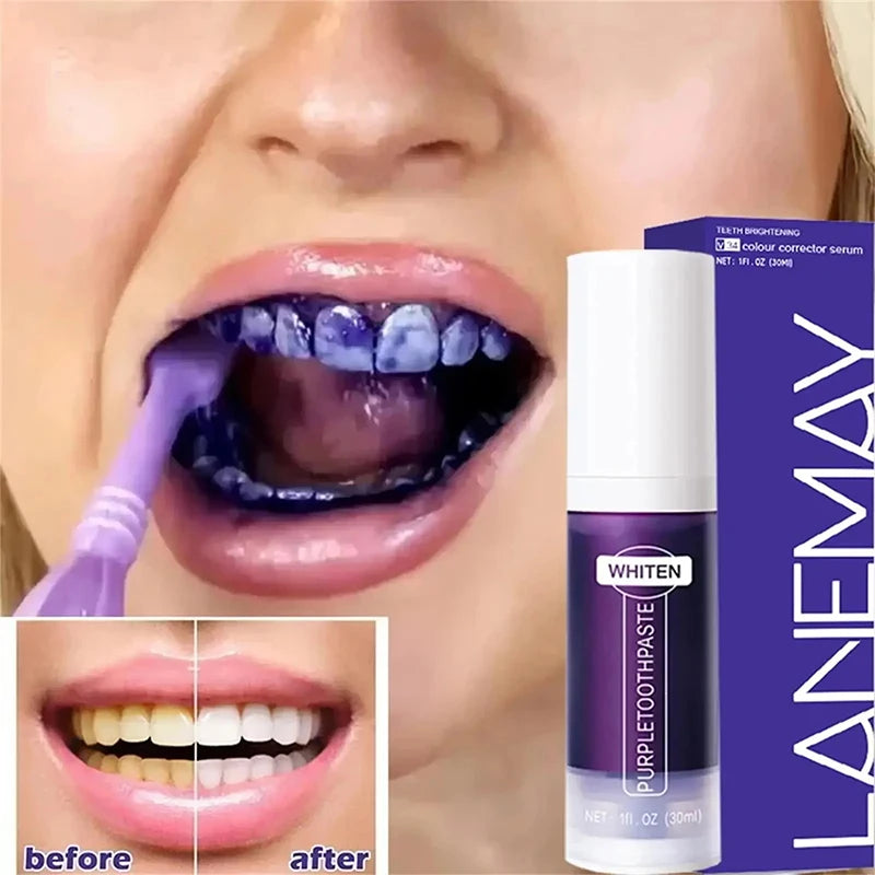 Sparkle Shine Whitening Paste
