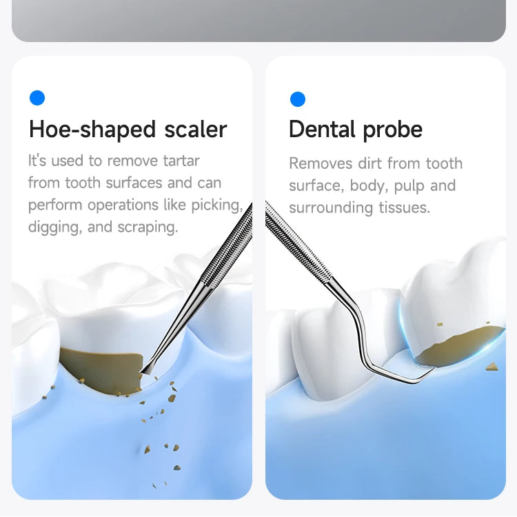 Dental tool set with scaler, probe, and smartphone displaying imaging capabilities on a gray background.