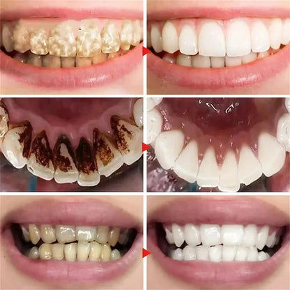Sparkle Shine Whitening Paste