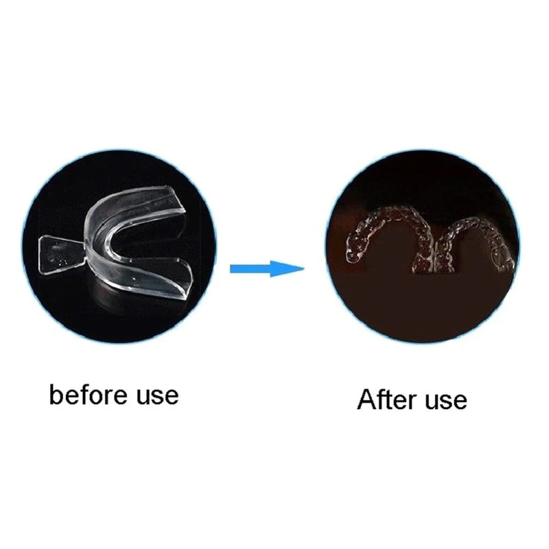 NoGrind Teeth Guard