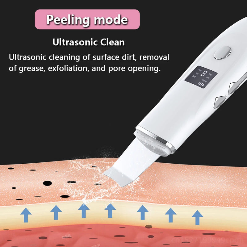 Ultrasonic Face Scrubber Kit