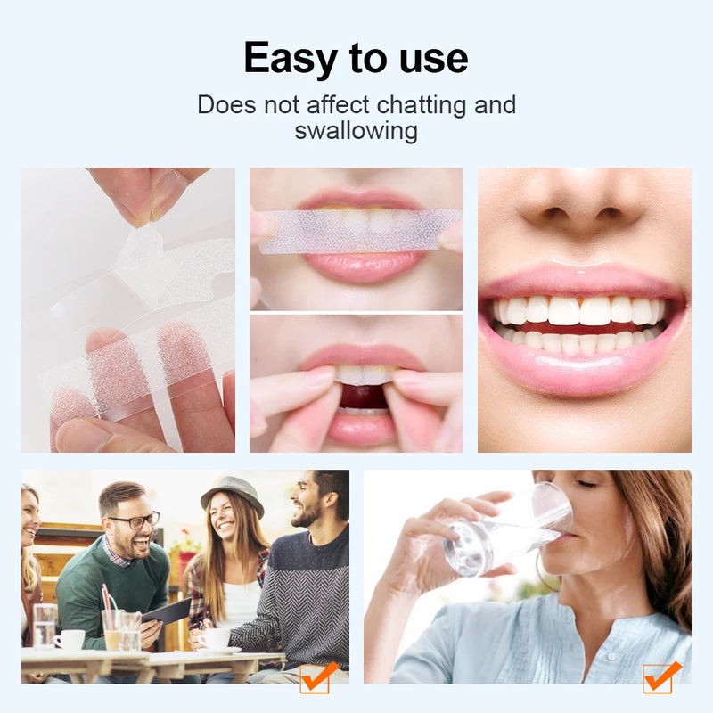 Teeth Whitening Strips