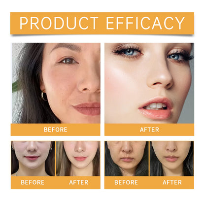 Nasolabial Repair & Smoothing Patches