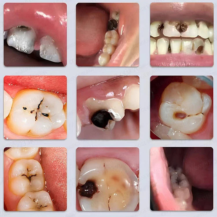 Brightfroth Whitening Toothpaste