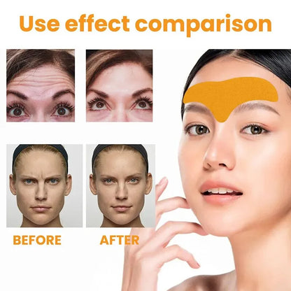 Hydrolyzed Collagen Forehead Wrinkle Patch