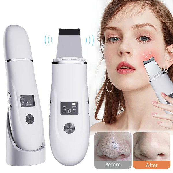 Ultrasonic Face Scrubber Kit