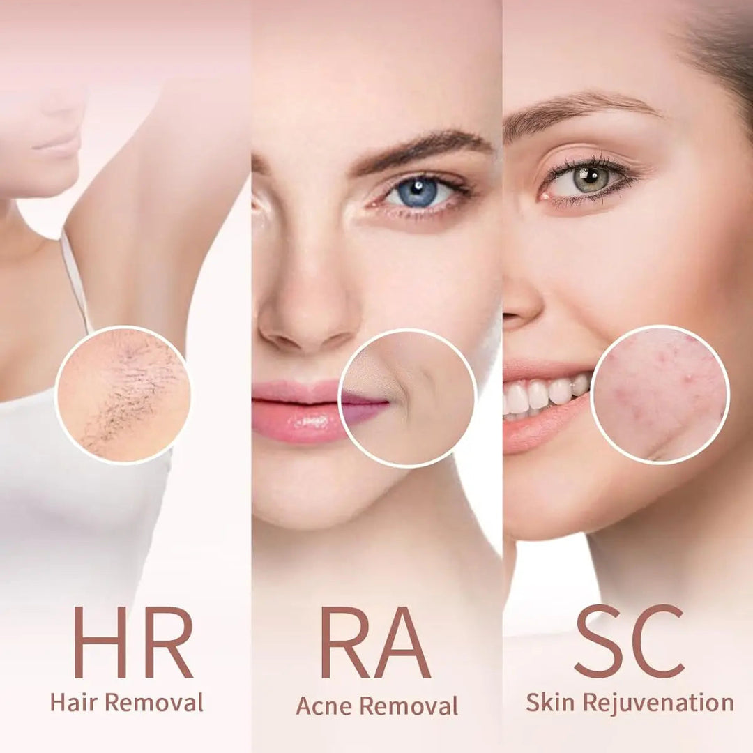 Flash 999 IPL Hair Removal Device