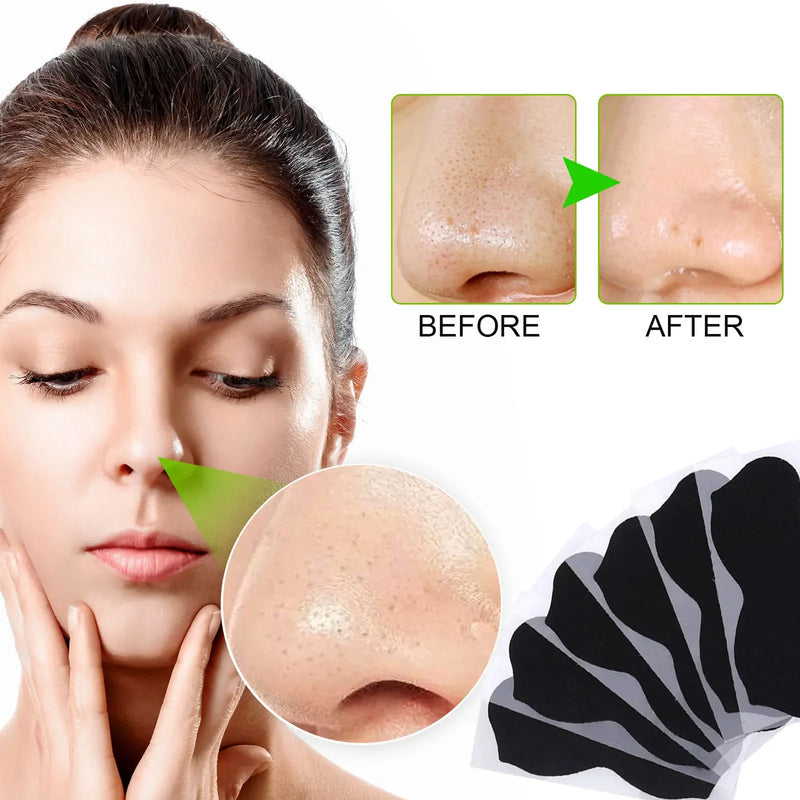 Blackhead Removal Nose strips