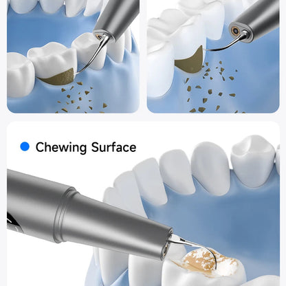 Teeth cleaning tool with close-up of dental instruments on a white background