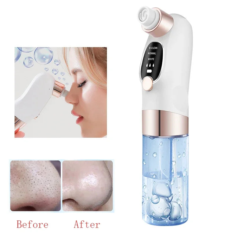 Bright Blackhead Remover