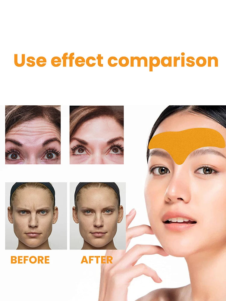 Hydrolyzed Collagen Forehead Wrinkle Patch