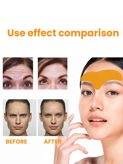 Hydrolyzed Collagen Forehead Wrinkle Patch