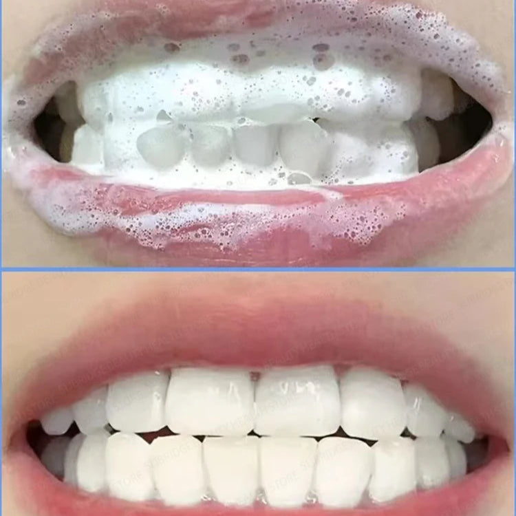 Brightfroth Whitening Toothpaste