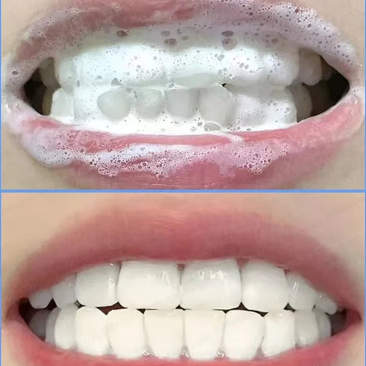 Brightfroth Whitening Toothpaste