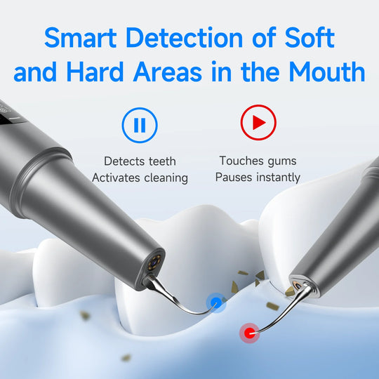 TartarCam Teeth Cleaner Kit