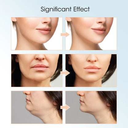 V-Line Face Lift Massager