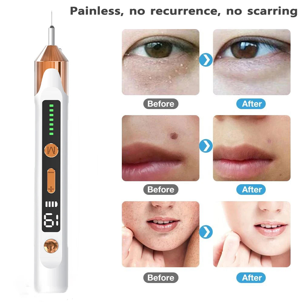 Advanced Plasma Skin Remover Pen