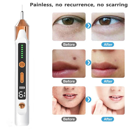 Advanced Plasma Skin Remover Pen