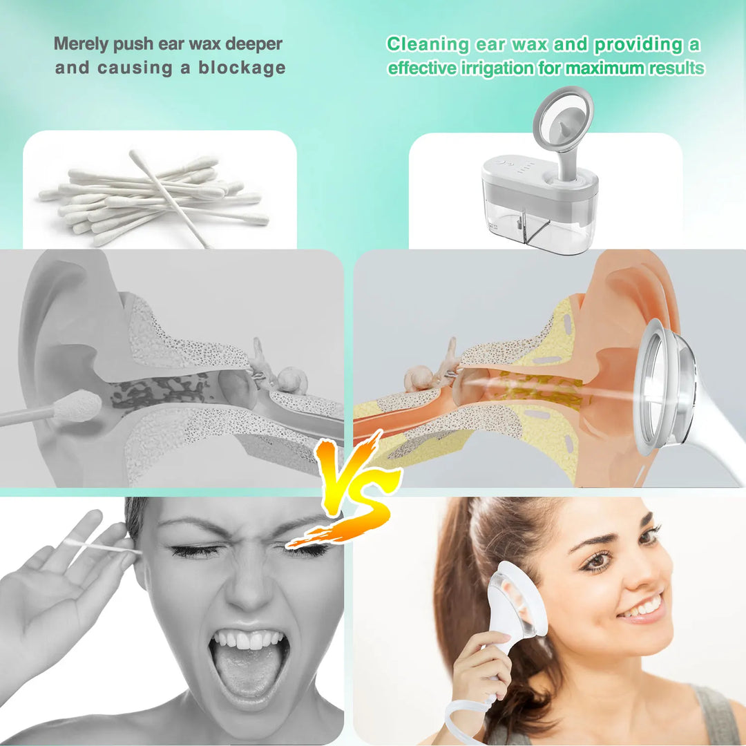Electric Ear Wax Remover