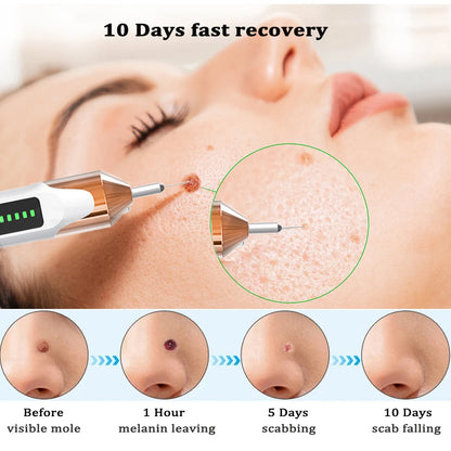 Advanced Plasma Skin Remover Pen