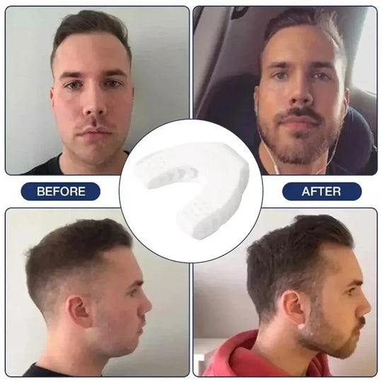 Jawline Exerciser
