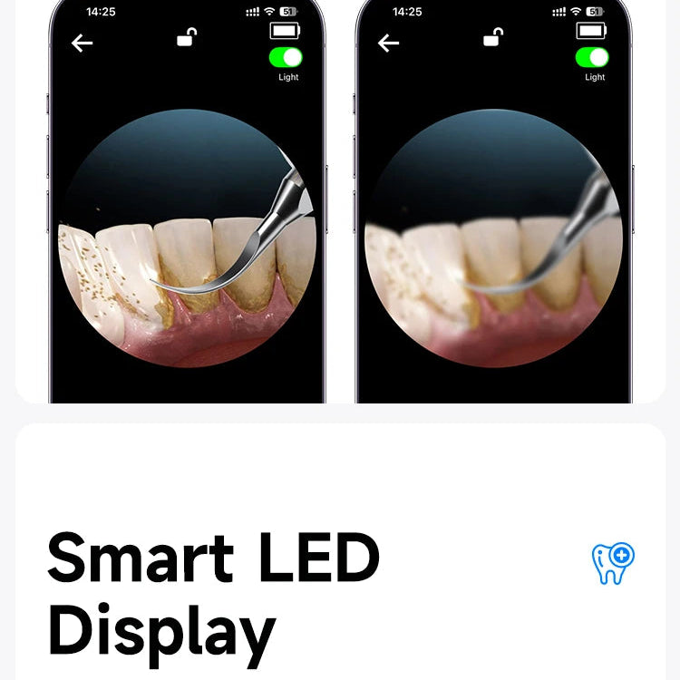 Two smartphone screens showing dental cleaning tools with text about smart LED display and custom modes.