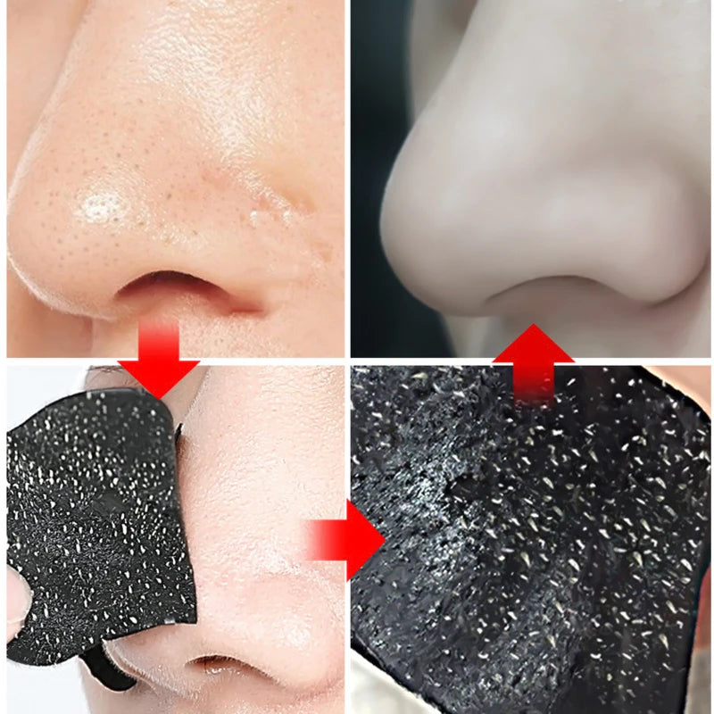 Blackhead Removal Nose strips