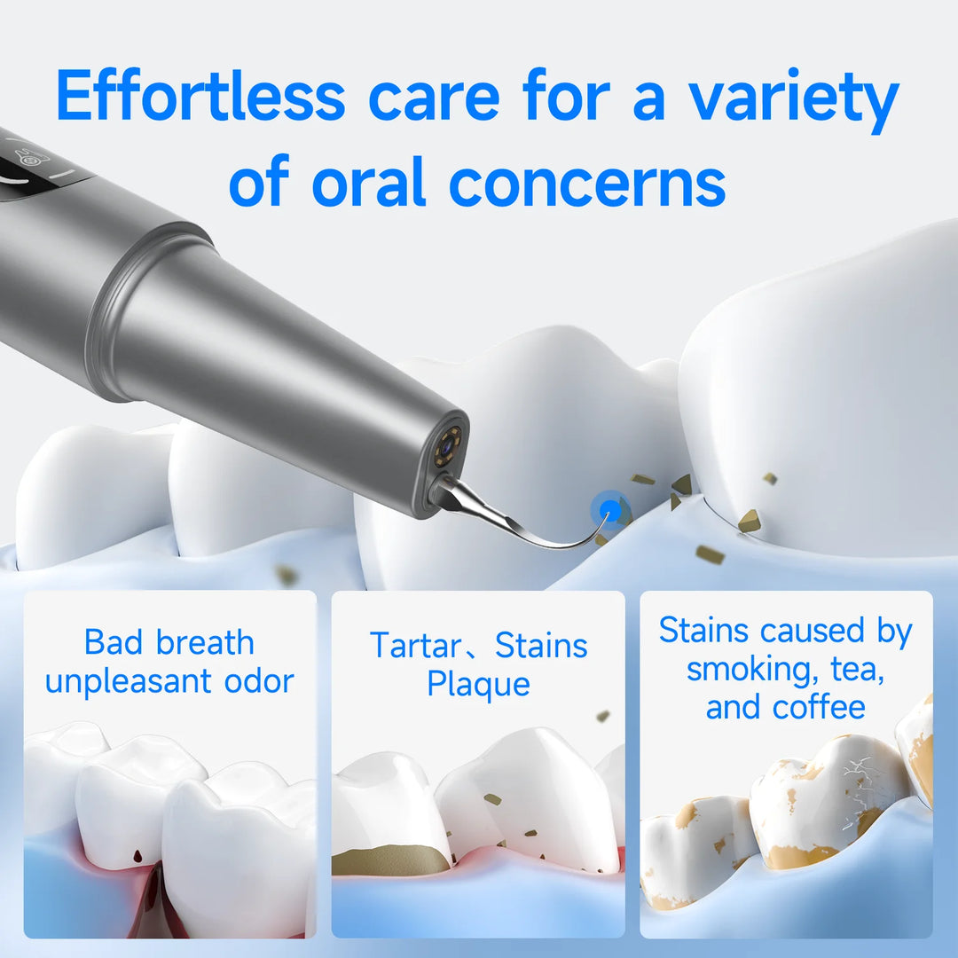 TartarCam Teeth Cleaner Kit
