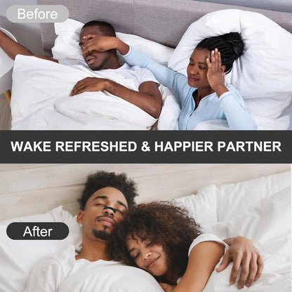 OxyBreeze Nose Strips