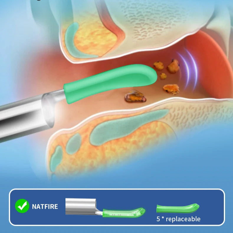 WaxCam Ear Cleaner