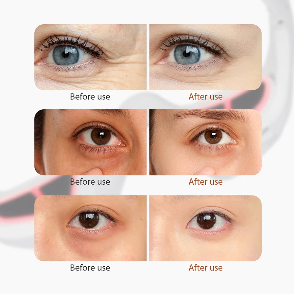 Eye Bag Buster Massager