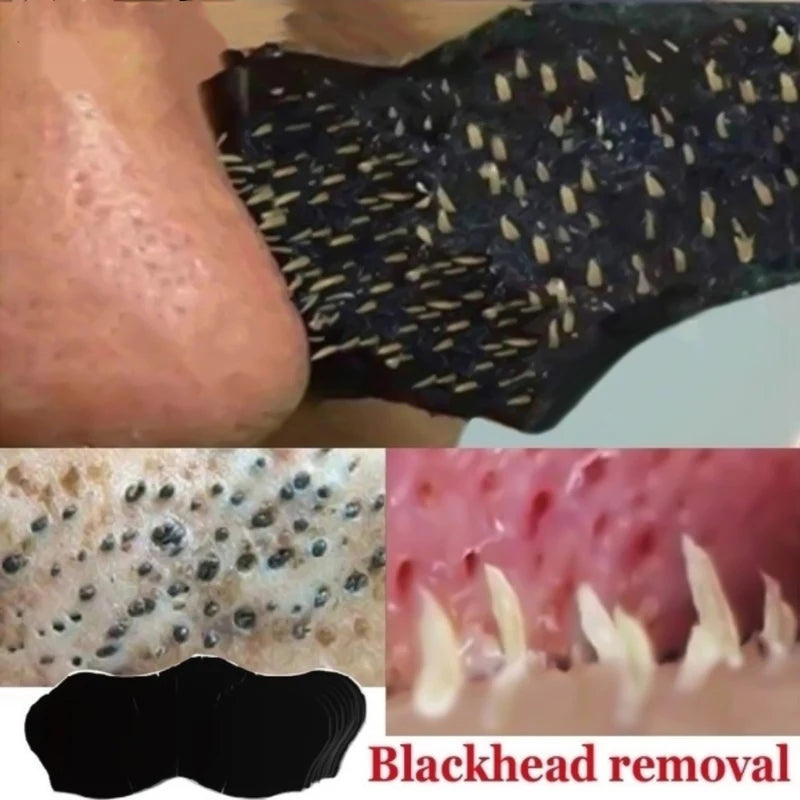 Blackhead Removal Nose strips