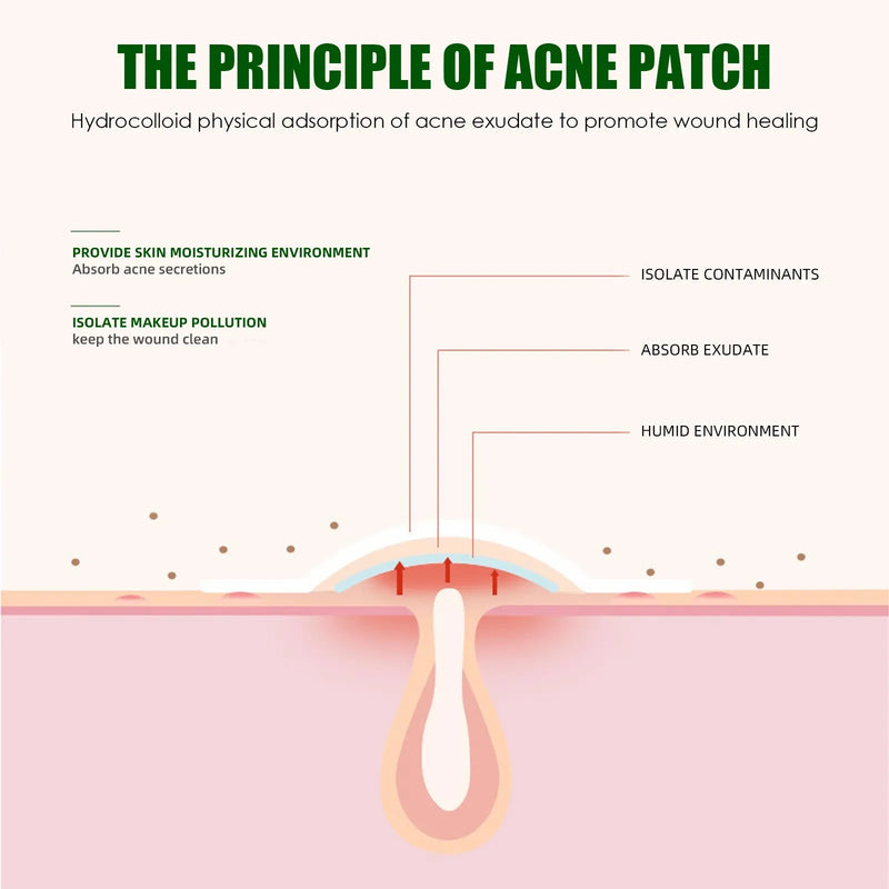 Hydrocolloid Pimple Patches