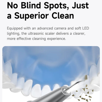 TartarCam Teeth Cleaner Kit