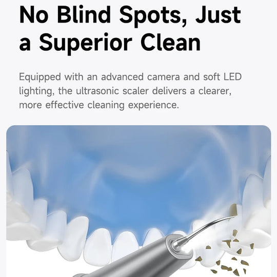TartarCam Teeth Cleaner Kit